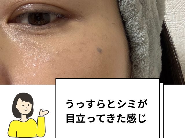 FASIOのオレンジコンシーラーは肝斑に効く？40代の汗だくマスク生活で1日検証してみた