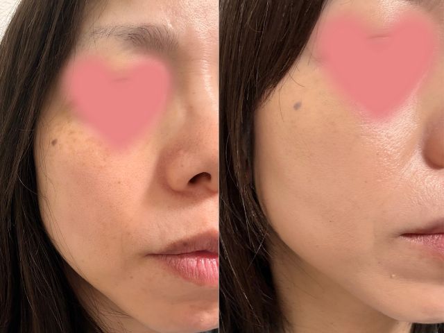 韓国コスメ愛用40代でシミがファンデで悪化する人へ｜厚塗り感ゼロで若見えする方法