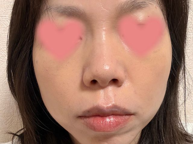 韓国コスメ愛用40代でシミがファンデで悪化する人へ｜厚塗り感ゼロで若見えする方法